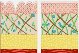 indicazioni alla procedura